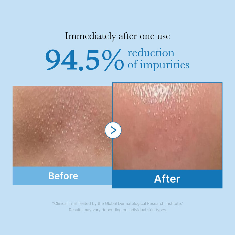 medicube zero pore blackhead dybderensende olie