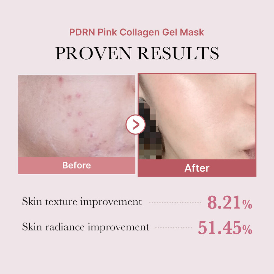 medicube salmon pdrn pink kollagen jelly gel maske