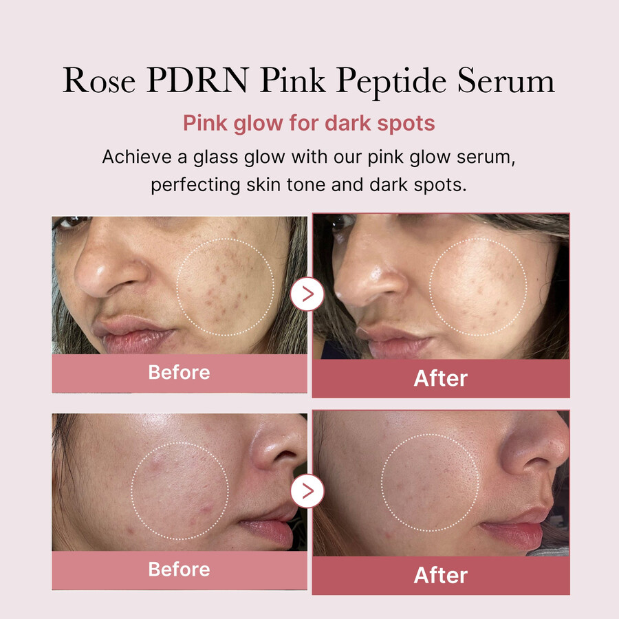 medicube pdrn pink peptideserum