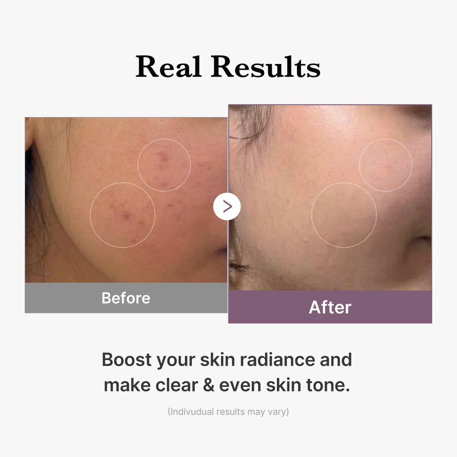 medicube age-r glutathion glow milk toner