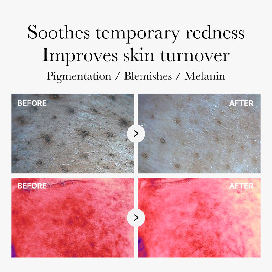 medicube røde ravsyre panthenol puder