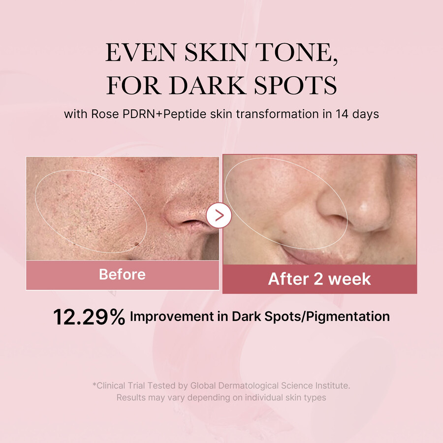 medicube pdrn pink peptide toner
