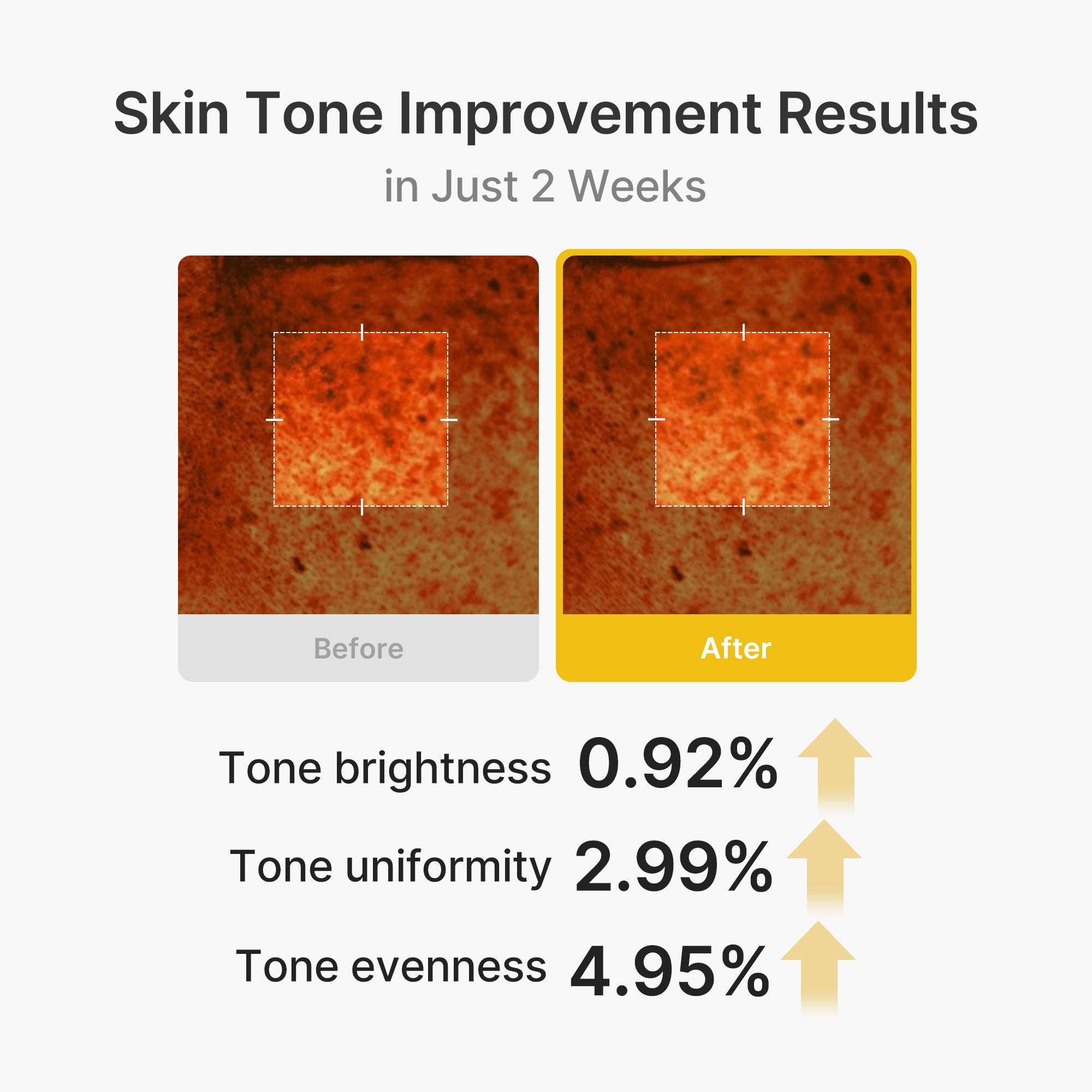 kojic acid gurkemeje vita kapselcreme